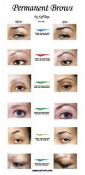 before-after-eyebrow-poster